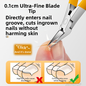 Mingxiang κλιπέρ νυχιών για ανάπτυξη – πλαστικό + ανοξείδωτο ατσάλι, φορητό για οικιακή χρήση, λαβίδες αυλακώσεων νυχιών, πολυλειτουργικά τσιμπιδάκια