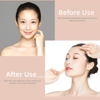 Fotonų odos atjauninimo kaukė kaklui ir dekoltėi su septynių spalvų LED apšvietimu (USB įkrovimas; 3-asis ir 4-asis režimai; sumažina raukšles ir atgaivina odą)