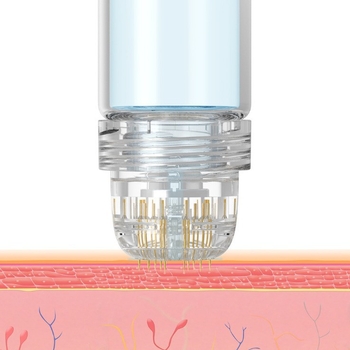 Shihan Hydrapen mikroneedle sistēma ar ūdenī šķīstošu adatu esenci, 64 adatas, pārnēsājams, mājas lietošanai