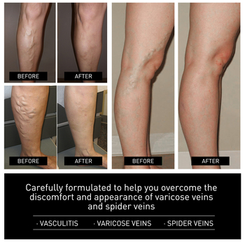 South Moon Ice Silk kvėpuojančios batų įdėklos sąnarių skausmų palengvinti, patinimo mažinimui ir kojų venų masažai — kodas SOA06-A082-1-BK1, ruduo