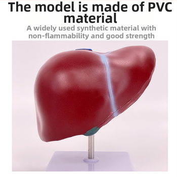 Υψηλής πιστότητας ανατομικό μοντέλο ήπατος με το σύστημα ηπατοχοληπαγκρεανο-σπληνο-δωδεκαδακτυλικό και ανάγλυφες βλάβες