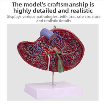 Υψηλής πιστότητας ανατομικό μοντέλο ήπατος με το σύστημα ηπατοχοληπαγκρεανο-σπληνο-δωδεκαδακτυλικό και ανάγλυφες βλάβες