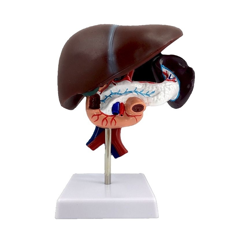 Ļoti reālistisks aknu anatomijas modelis ar hepatobiliāro–pankreato-splēnas-duodēnu sistēmu un reljefa bojājumiem