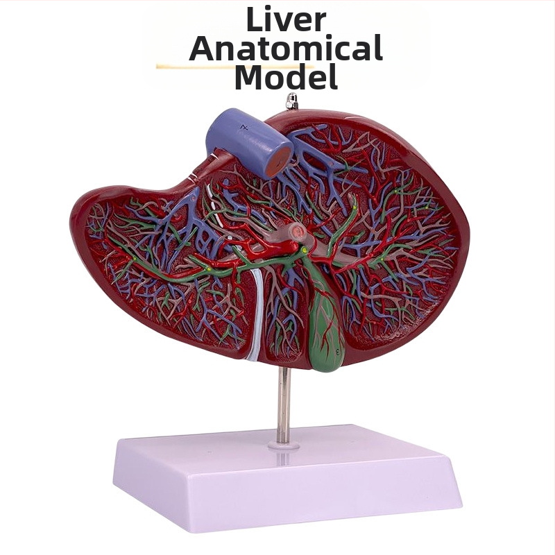 Ļoti reālistisks aknu anatomijas modelis ar hepatobiliāro–pankreato-splēnas-duodēnu sistēmu un reljefa bojājumiem