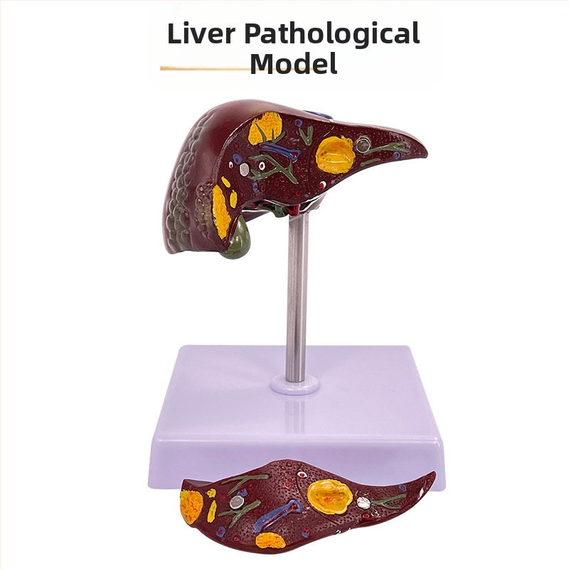 Ļoti reālistisks aknu anatomijas modelis ar hepatobiliāro–pankreato-splēnas-duodēnu sistēmu un reljefa bojājumiem