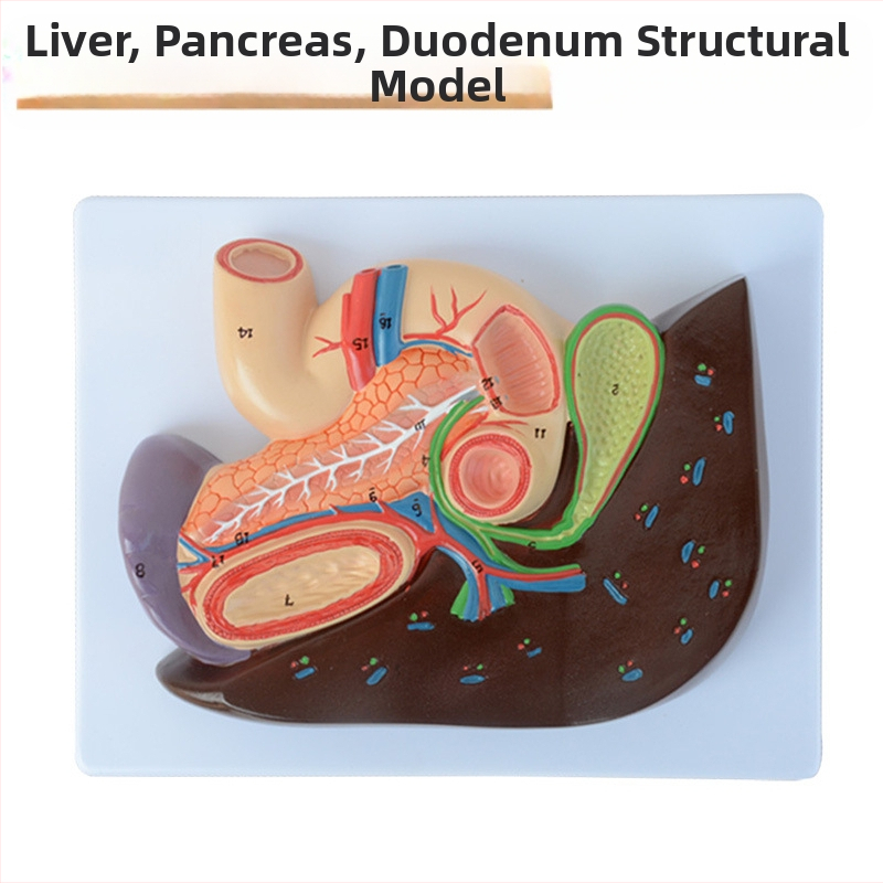 Ļoti reālistisks aknu anatomijas modelis ar hepatobiliāro–pankreato-splēnas-duodēnu sistēmu un reljefa bojājumiem