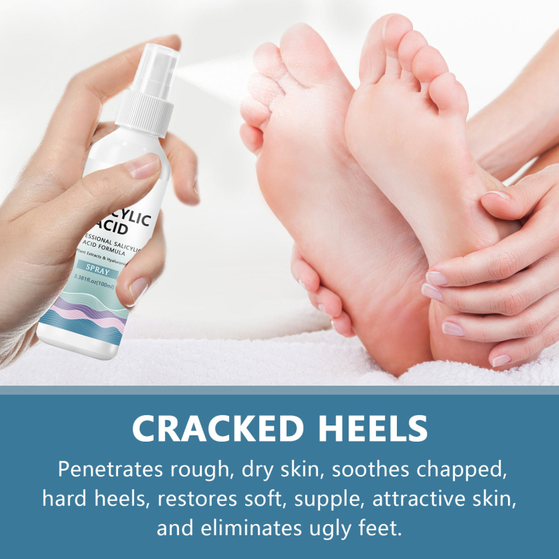 Спрей за стъпала със салицилова киселина, подхранващ и хидратиращ, SPF30+, подходящ за универсална кожа