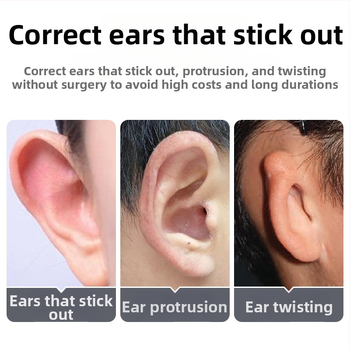 Αόρατο αυτοκόλλητο σιλικόνης για διόρθωση του αυτιού – για βρέφη, παιδιά και εφήβους; καθαρό βάρος 50 g.