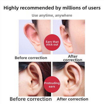 Αόρατο αυτοκόλλητο σιλικόνης για διόρθωση του αυτιού – για βρέφη, παιδιά και εφήβους; καθαρό βάρος 50 g.