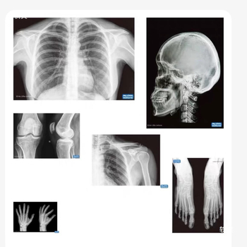 Παιχνίδι προβολής φωτός και σκιών με θέμα τα ζώα και τον ανθρώπινο σώμα σε φωτεινό τραπέζι – Εκπαιδευτικό παιχνίδι; Υλικό: Άλλο; Μάρκα: Άλλο; Τύπος: Άλλα εκπ/επιστημονικά παιχνίδια; Ηλικία: 0–3 ετών