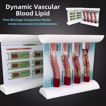 Dinaminis kraujagyslių modelis iš plastiko su didelio tankio užsikimšimu ir plokštelių trombu – mokymo modelis