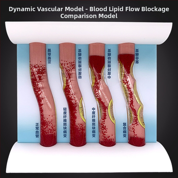 Δυμαμικό μοντέλο αγγειακού συστήματος από πλαστικό για επίδειξη απόφραξης υψηλής πυκνότητας και θρόμβου πλάκας – διδακτικό μοντέλο