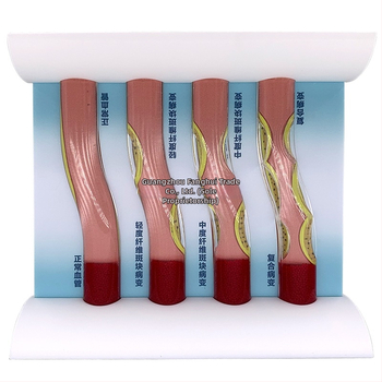 Δυμαμικό μοντέλο αγγειακού συστήματος από πλαστικό για επίδειξη απόφραξης υψηλής πυκνότητας και θρόμβου πλάκας – διδακτικό μοντέλο