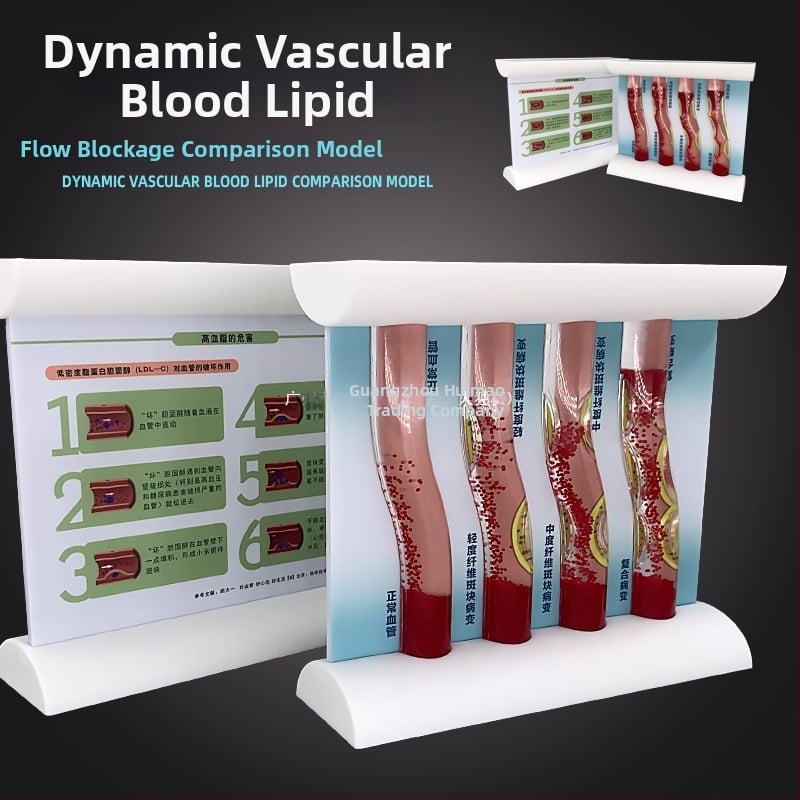 Динамичен модел на кръвоносен съд от пластмаса за демонстрация на висока плътност на запушване и плаков тромб – учебен модел