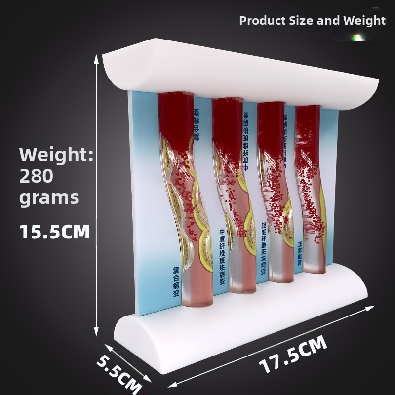 Динамичен модел на кръвоносен съд от пластмаса за демонстрация на висока плътност на запушване и плаков тромб – учебен модел