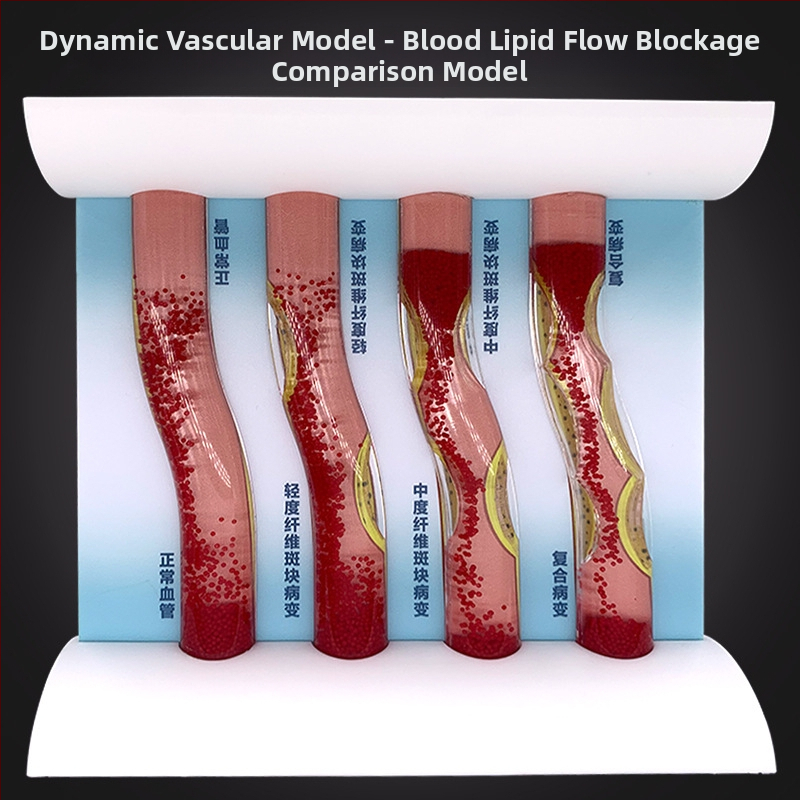 Динамичен модел на кръвоносен съд от пластмаса за демонстрация на висока плътност на запушване и плаков тромб – учебен модел