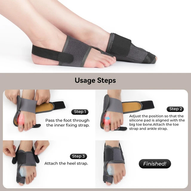 Bomike Hallux Valgus korektorius didžiajam kojų pirštui su aliuminio juostele, kvėpuojančia medžiaga ir Velcro užtrauktuku; tinka bėgimui, važiavimui dviračiu ir masažams