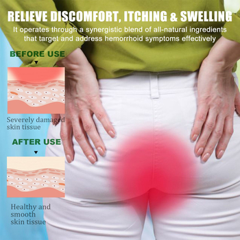 EELHOE Augu izcelsmes hemoroīdu kopšana – Perianālas zonas kopšana ar augu ekstraktiem, augu smarža, universāls ādas tips, normāla specifikācija
