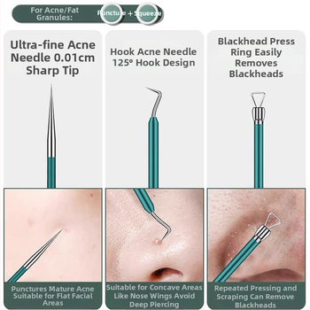 Σετ βελονών ακμής από ανοξείδωτο ατσάλι – εργαλεία ομορφιάς Little genius