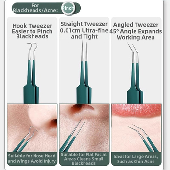 Σετ βελονών ακμής από ανοξείδωτο ατσάλι – εργαλεία ομορφιάς Little genius