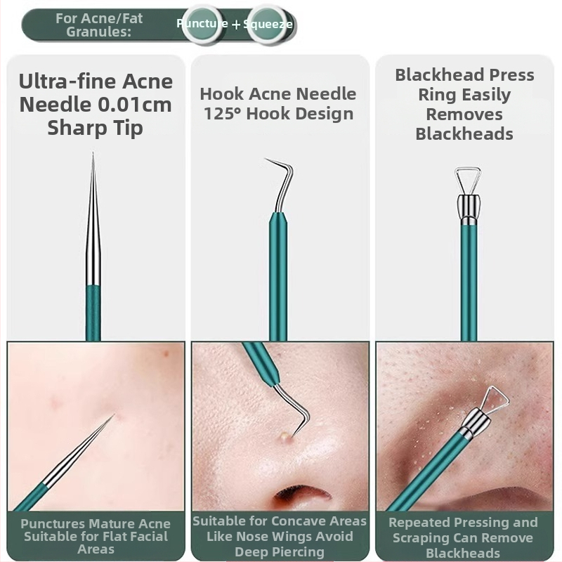 Σετ βελονών ακμής από ανοξείδωτο ατσάλι – εργαλεία ομορφιάς Little genius