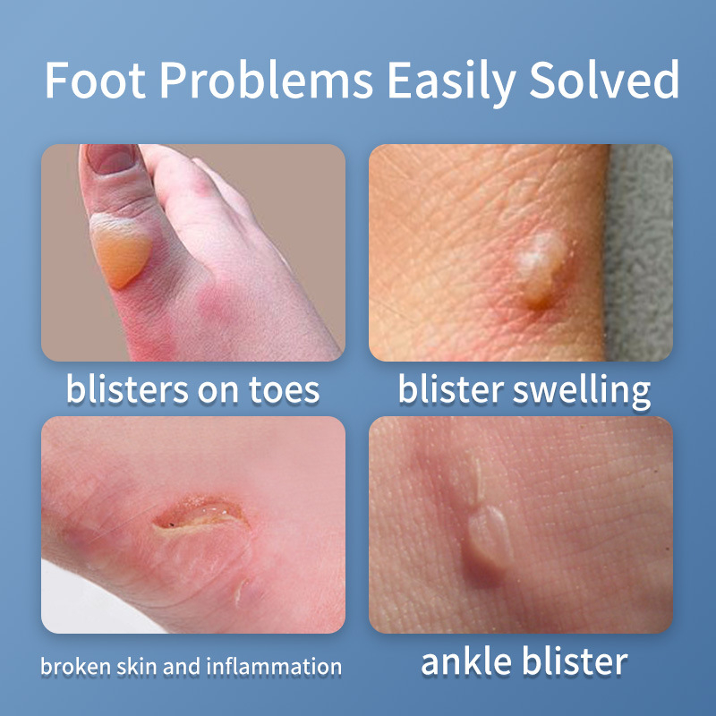 Smileplus hidrokoloidinės kulnų pagalvėlės – atsparios dėvėjimui, nematomi kulnų lipdukai, 2 mm storis, vientisas modelis, su logotipu