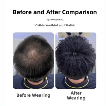 Vyrinė trumpa natūralaus įvaizdžio peruka su viršutinės plaukų dalies tūrio papildymu, mechaninė konstrukcija, karščiui atspari sintetinis pluoštas, modeliai BF374 BF375 BF376