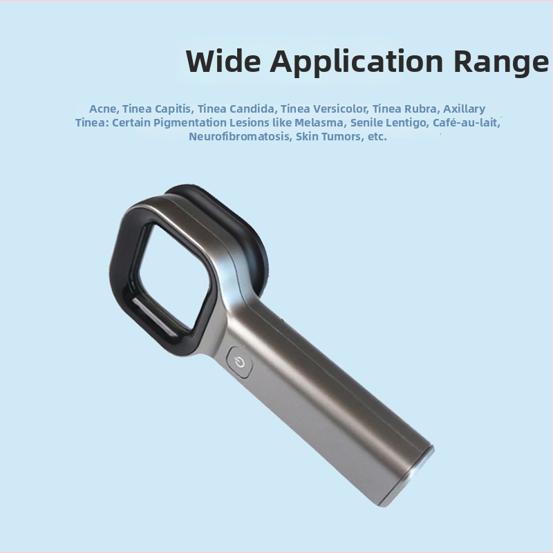 Island Shuo DS-W01 Nešiojamos odos tyrimo priemonės su medine lempa – veido, rankų, kojų ir kūno priežiūra, suaugusiems, pirmasis lygis, 2023