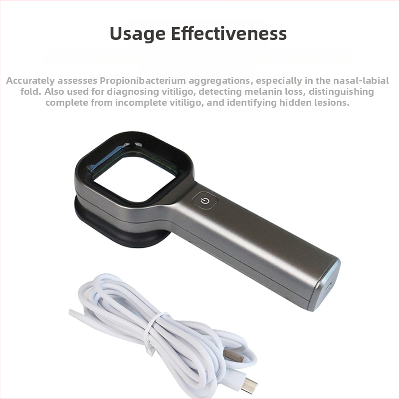 Island Shuo DS-W01 Nešiojamos odos tyrimo priemonės su medine lempa – veido, rankų, kojų ir kūno priežiūra, suaugusiems, pirmasis lygis, 2023