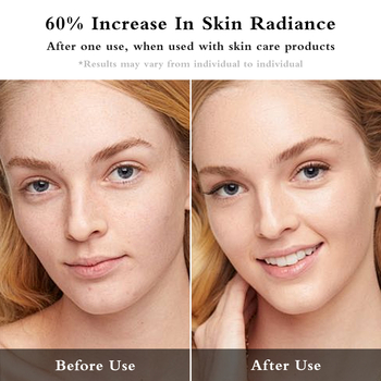 EMS uređaj za oči s mikrostrujom i fototerapijom, USB napajanje, prijenosno, ugrađena baterija 800–1000 mAh, IPX0, za kućnu upotrebu