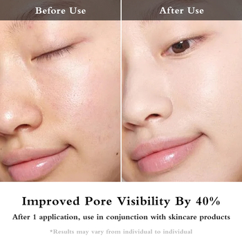 EMS uređaj za oči s mikrostrujom i fototerapijom, USB napajanje, prijenosno, ugrađena baterija 800–1000 mAh, IPX0, za kućnu upotrebu