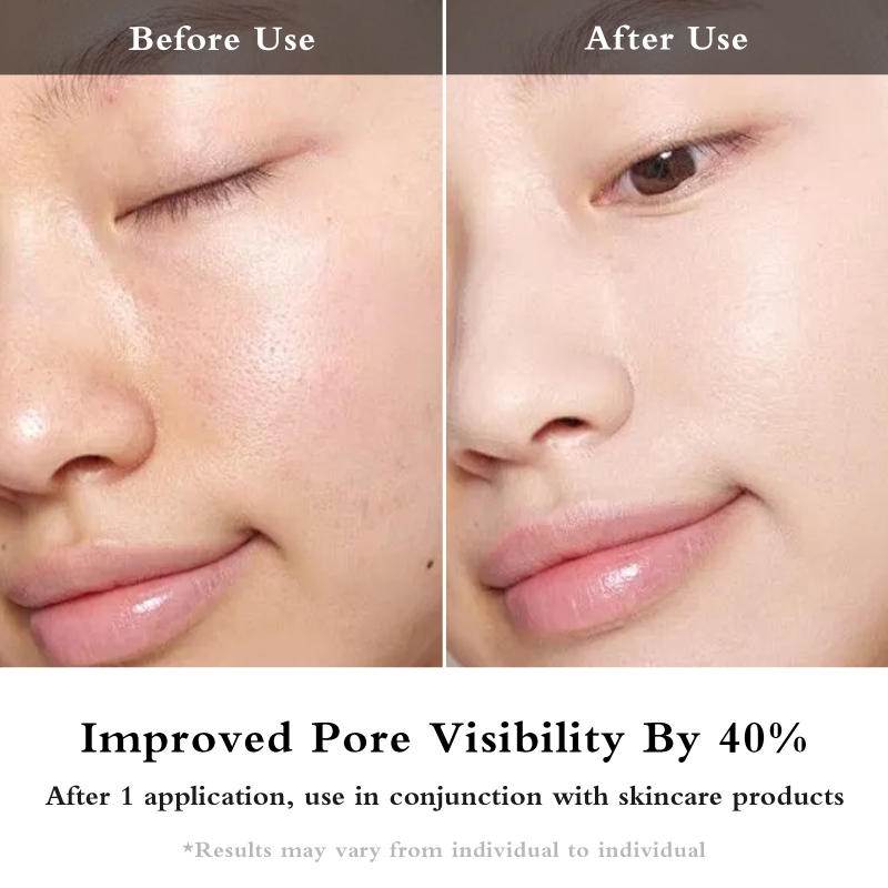 EMS uređaj za oči s mikrostrujom i fototerapijom, USB napajanje, prijenosno, ugrađena baterija 800–1000 mAh, IPX0, za kućnu upotrebu