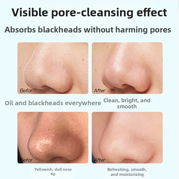 Teekstraktiga mustade laikude eemaldamise mask – kolmeosaleline komplekt, T-tsooni hooldus, pooride ahendamine, sebumi kontroll, niisutus