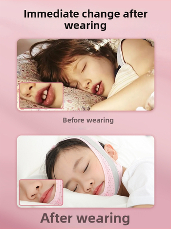 Vaikams skirtas burnos kvėpavimo korekcijos diržas — užkerta kelią burnos atidarymui miego metu; Prekės ženklas Li Yue, Modelis: Mouth Breathing Correction Belt