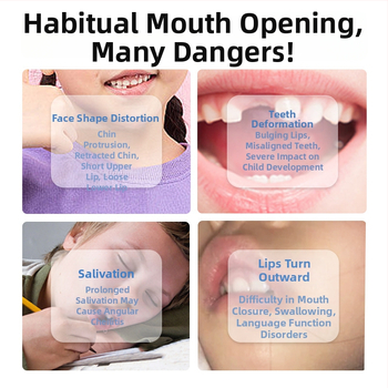 Huulelihaste treener suukaudse hingamise korrigeerimiseks – anti-snoring seade, täiskasvanutele, PP-materjal, kohandamiseta, adenoidses hüpertroofia kontekstis