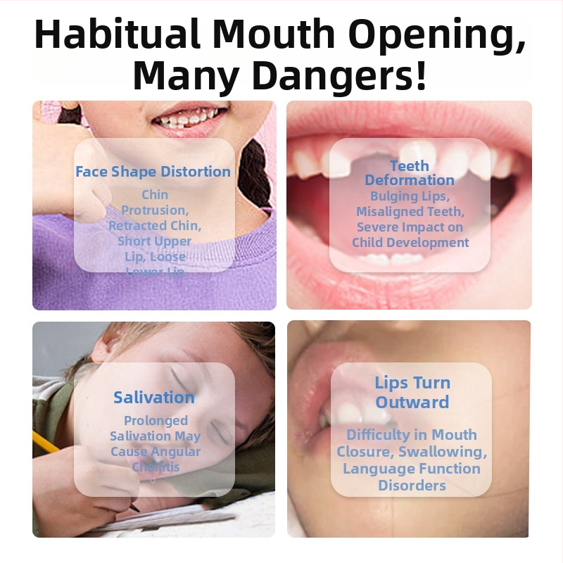 Lūpu muskuļu trenētājs mutiskās elpošanas korekcijai – anti-snoring ierīce, pieaugušajiem, PP materiāls, bez pielāgošanas, kontekstā adenoīdās hipertrofijas