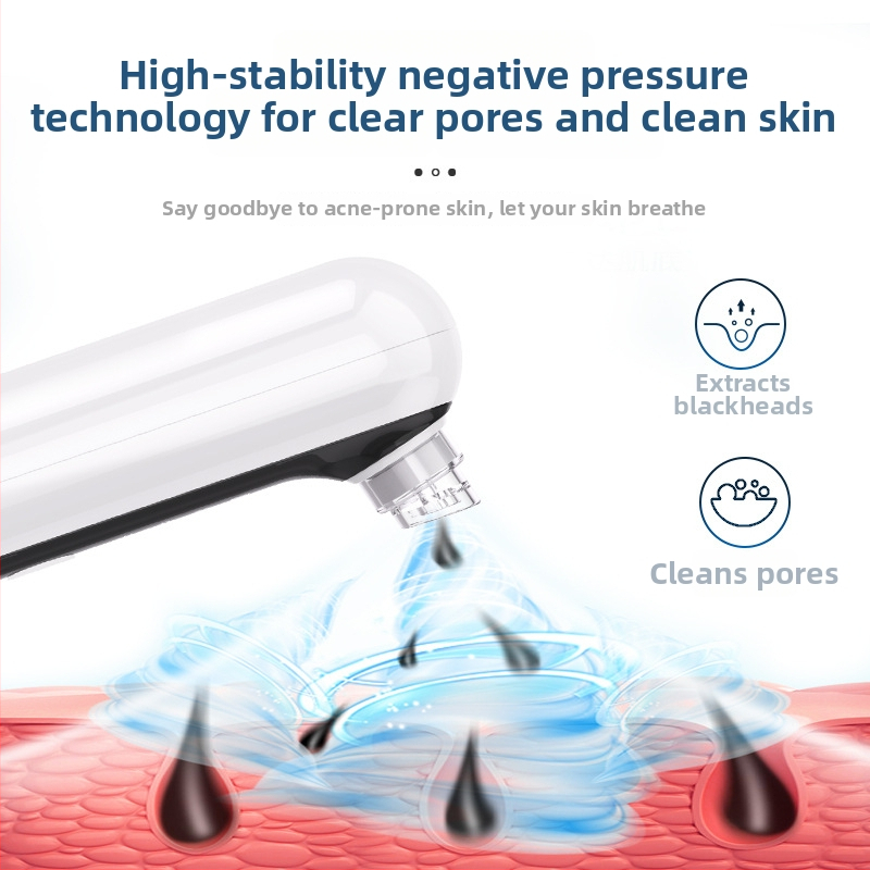 Ultragarsinis porų siurbimo valiklis 2309, 3 greičiai, ABS korpusas, veido porų valymas