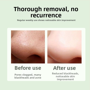 Vakuuminis veido valymo įrenginys juodoms inkštirams pašalinti, modelis DYM028, Define Beauty, aiškiai pašalina inkštirus ir spuogus, 3 galingumo režimai