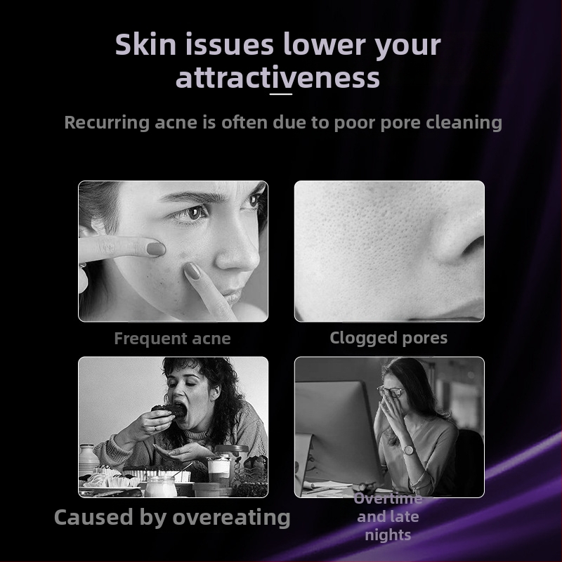 HD vizuálny akné ihla – elektrický čistič pórov HWQ038, čistenie pórov, CE RoHS FCC certifikáty, uvedený na trh 2023, obal: elektroplating s pieskovaním