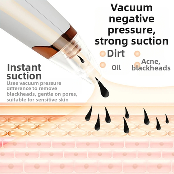 Juodųjų dėmių siurbimo įrenginys — elektrinis, namų naudojimui, stiprus siurbimas, modelis 5678, 3 greičiai, odai saugu