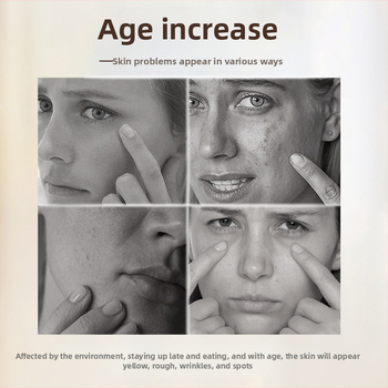 Fotonu skaistuma ierīce (divu joslu, portatīvā rokas ierīce, ādas atjaunošana, gaišums, mājas lietošanai)