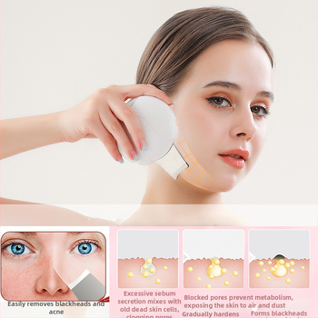 Ultraskaņas ādas attīrīšanas ierīce melno punktu noņemšanai, Modelis CPJ-68, 5 līmeņu regulēšana, korpuss ABS+metāls