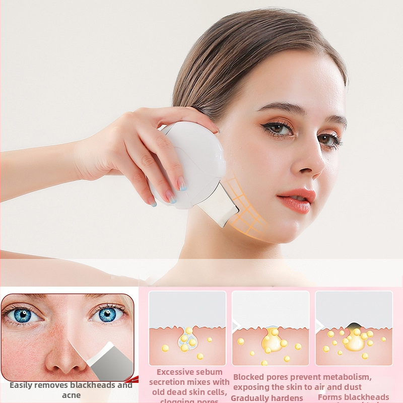 Ultraskaņas ādas attīrīšanas ierīce melno punktu noņemšanai, Modelis CPJ-68, 5 līmeņu regulēšana, korpuss ABS+metāls