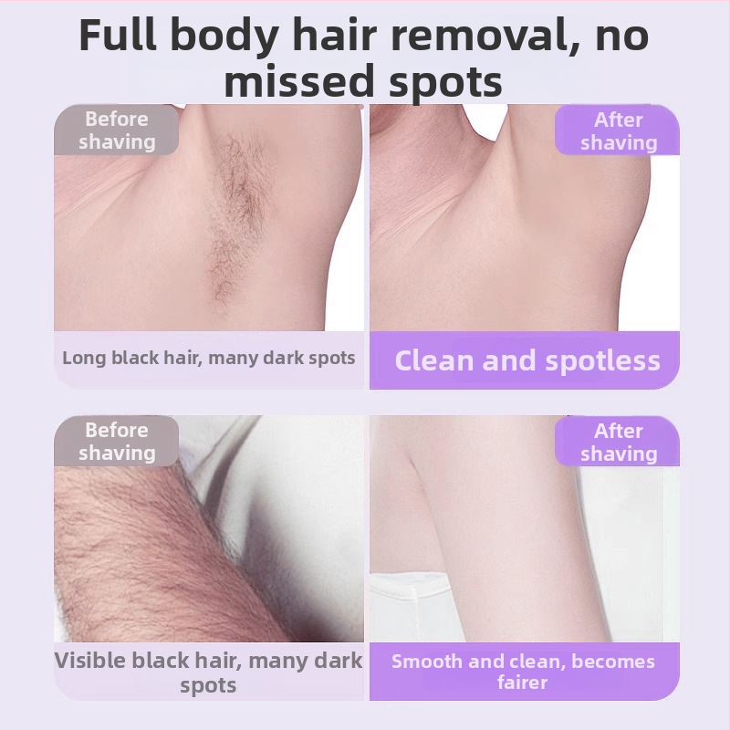 TMQ-623 Elektriline habemenuga ja karvade eemaldaja teemantnugaga, USB-laetav, märg- ja kuivas kasutuses, kogu keha jaoks