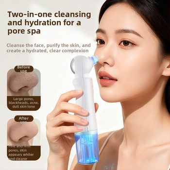 Chigo X20 vakuuminis porų valymo įrenginys su karštojo kompreso funkcija poroms atidaryti, 4 lygis