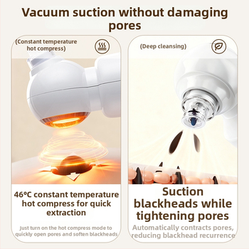 Chigo X20 vakuuminis porų valymo įrenginys su karštojo kompreso funkcija poroms atidaryti, 4 lygis