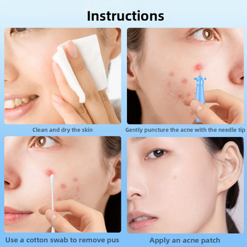 Vienkartinė nerūdijančio plieno spuogų išspaudimo adata, prekės kodas z7NAR7rA, prekė Kita