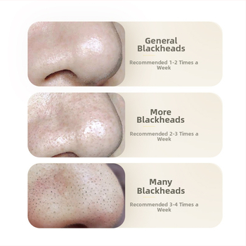 Bisutang Liusheng Peptidų nuluojama kaukė prieš raukšles, skirta visų tipų odai, riebalų kontrolė, gilus valymas.