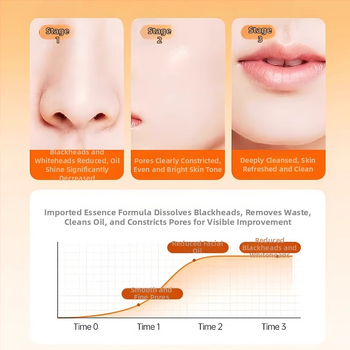 BUV Molio kaukė su morkų komponentu – Riebalų reguliavimas, Juodųjų spuogų šalinimas, Porų sutraukimas, Giliai valantis