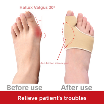 CY-161 nykščio korektoriaus ortozė, kvėpavimo medžiagos TPE, Lycra ir aukštos elastingumo šilkas, ortotinis stilius, tinka visoms sezonoms